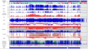 Exemple de graphique de polygraphie ventilatoire.